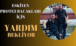  Protez Bacak İçin Yardım Bekliyor