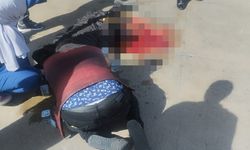 Otobüsün altında kalan hamile kadının bacağı koptu
