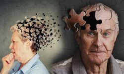 Demans vakalarının yüzde 50 ila 70’i Alzheimer kaynaklı