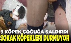 8 yaşındaki çocuğa 5 sokak köpeği saldırdı