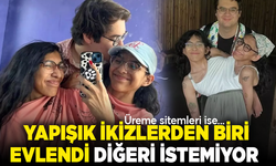 Bir garip olay! Yapışık ikizlerden biri evlendi, diğeri istemiyor
