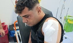 İş görüşmesi için gitti, ölümden döndü