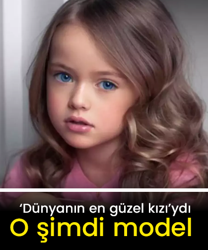 “Dünyanın en güzel kızı” büyüdü, güzelliğiyle sosyal medyayı sallıyor!