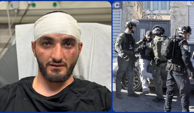 İsrail polisinden gazetecilere sert müdahale
