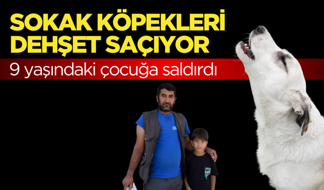 Manisa'da sahipsiz köpeğin saldırdığı çocuk yaralandı