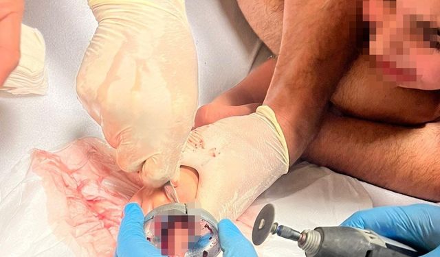 Küçük çocuğun parmağı çeşme aynasına sıkıştı