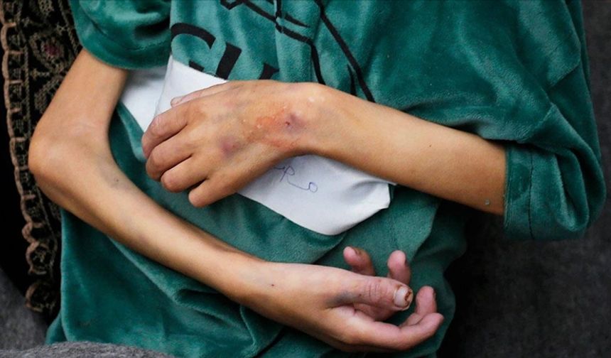 Gazze'de bir haftada 4 çocuk daha "açlıktan" öldü